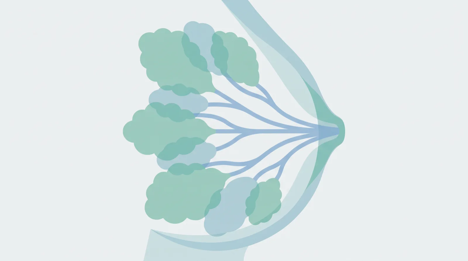 نمودار ساده ساختار پستان شامل مجاری شیر و غده‌های تولید شیر، محل شروع انواع سرطان پستان