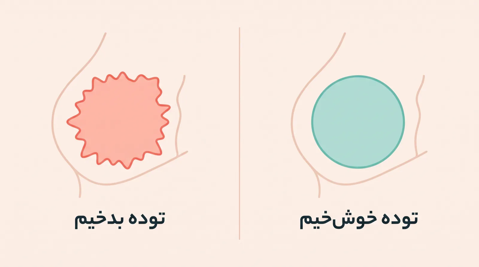 مقایسه‌ی تصویری توده‌ی خوش‌خیم و بدخیم سینه با برچسب مرز مشخص در برابر مرز نامنظم