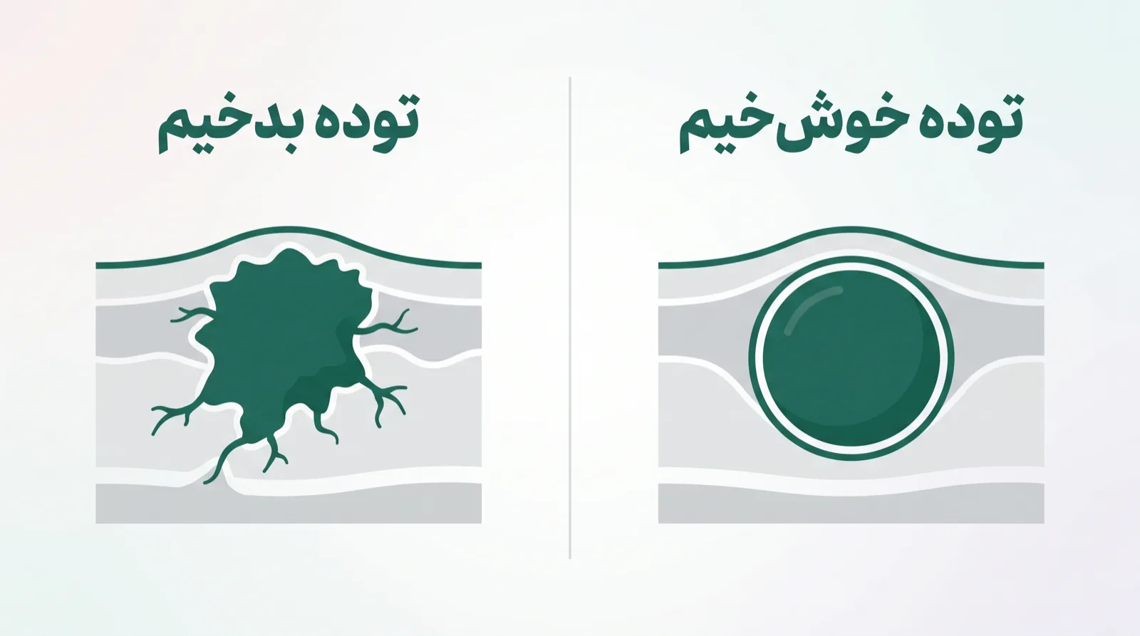 برش زیر پوست: توده‌ی خوش‌خیم جدا از بافت اطراف و آزاد، در برابر توده‌ی بدخیم که به بافت اطراف چسبیده و به همین دلیل زیر انگشت جابه‌جا نمی‌شود